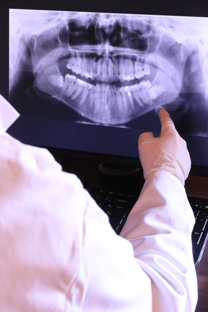 Best Emergency Root Canal Treatment in College Park, GA